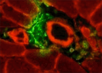 Image: Mesenchymal stem cells (green) accumulate in skeletal muscle following exercise and release growth factors to spur regeneration (Photo courtesy of  Marni Boppart, UIUC.